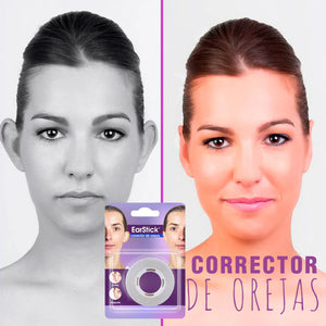 🔥CORRECTOR DE OREJAS EARSTICK🦻