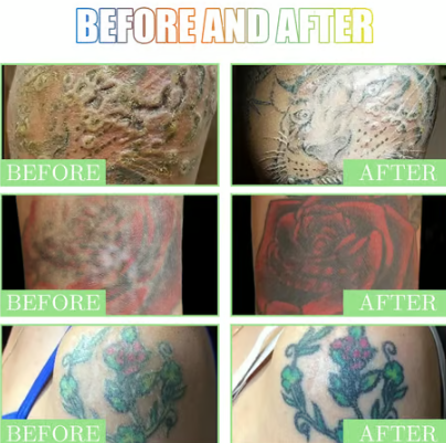 🔥Crema Para Revitalizar Tatuajes, paga 1 y lleve 2🧴