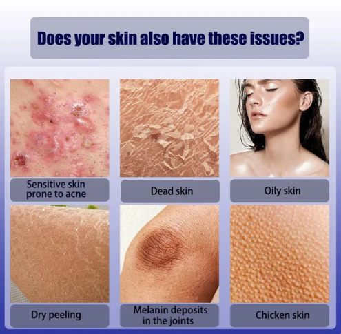 ✨ Exfoliante corporal de vaselina blanca KISSMWAH (COMPRA 1 Y LLÉVATE OTRO GRATIS)