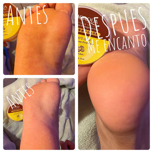 🧴 Suavipies No Callos 180gr + envió gratis  🎁